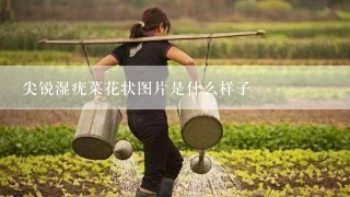 尖锐湿疣菜花状图片是什么样子